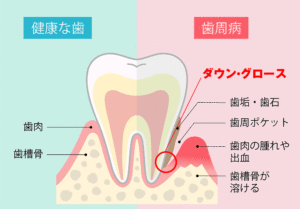 ダウングロース・国領あおぞら歯科